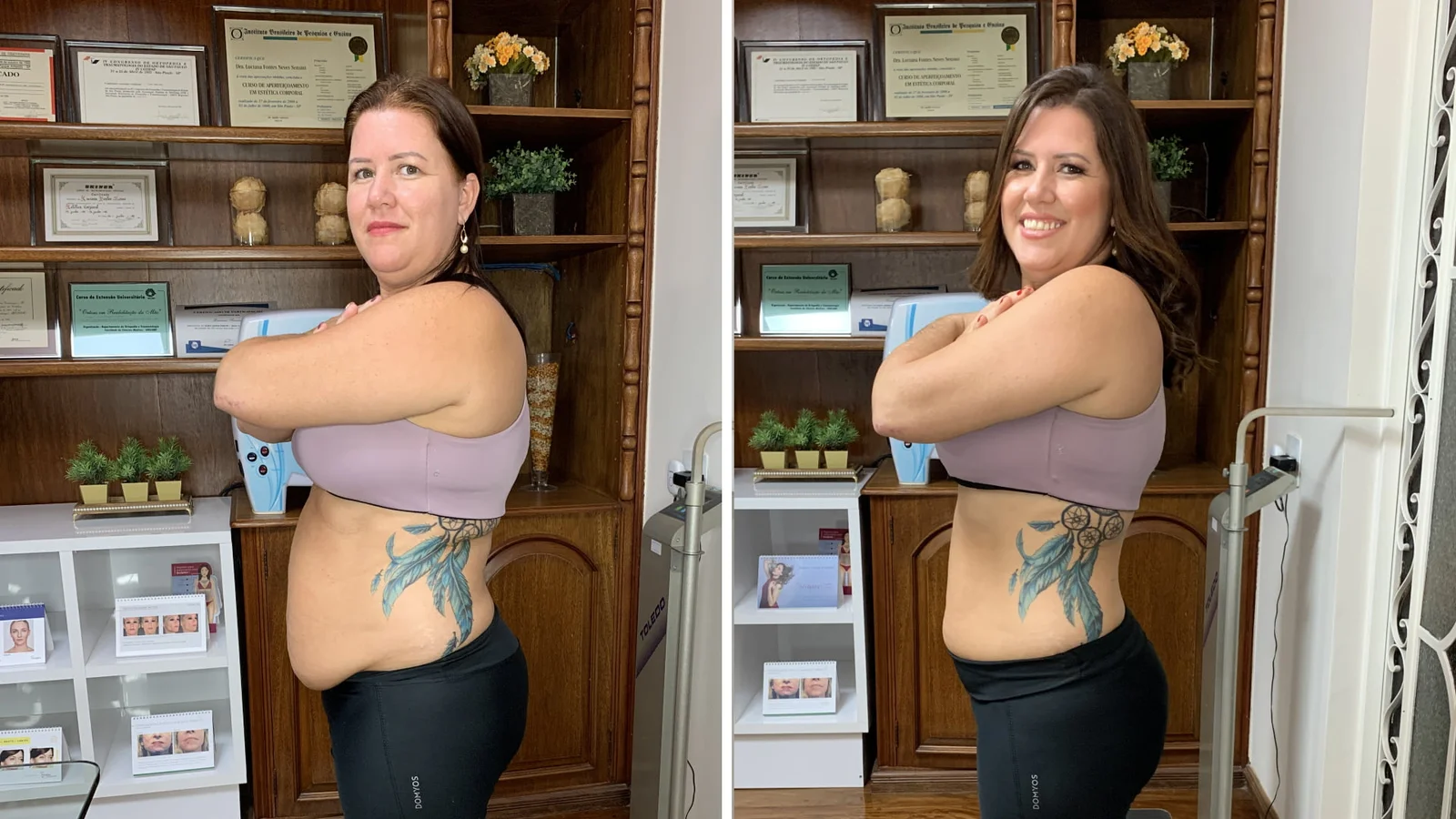 Antes e depois da Sandra